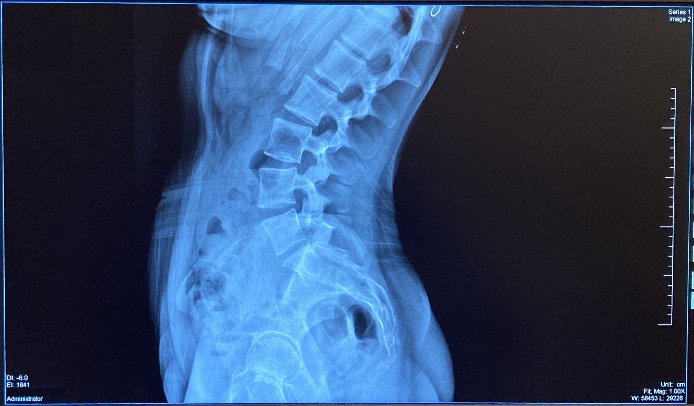 Abdomen-Xray